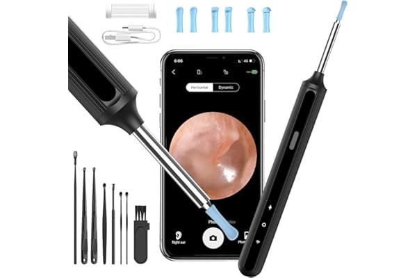 Otoskop: Zur Untersuchung des Gehörgangs und des Trommelfells