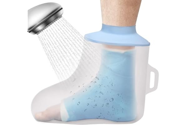 Gipsschutz:: Schutzlösung für Kanten, Spitzen und Enden